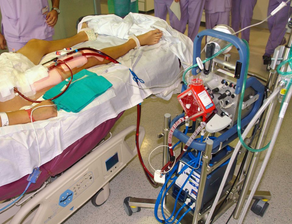 La_Fe_500_pacientes_ECMO